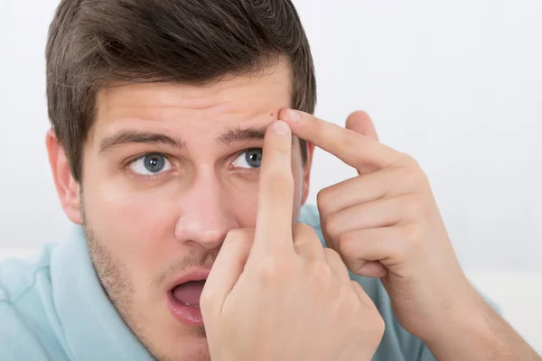 Jovem Chocado Olhando Para Pimple Testa — Fotografia de Stock