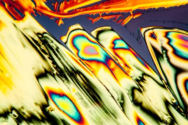 Erhöhter Harnstoff Polarisiertem Licht Kristalle 100X — Stockfoto