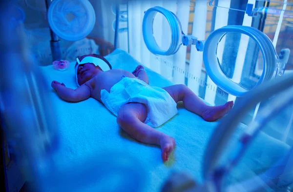 青い紫外線の下で写真療法を受けている新生児は — ストック写真