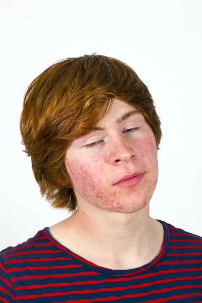 Ελκυστική Αγόρι Στην Εφηβεία Κόκκινα Μαλλιά — Φωτογραφία Αρχείου