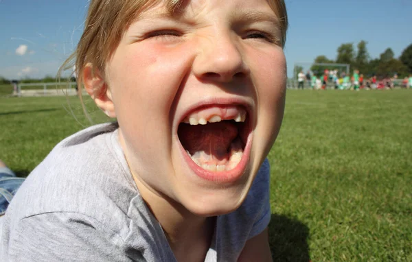 Menina Loira Mii Dente Lacuna — Fotografia de Stock