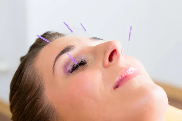 Woman at acupuncture with needles in face receiving alternative treatment