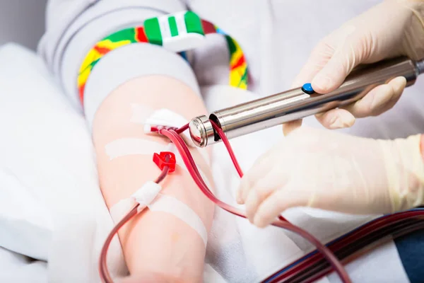 Sangue Correr Através Cateter Venoso Durante Doação Sangue — Fotografia de Stock