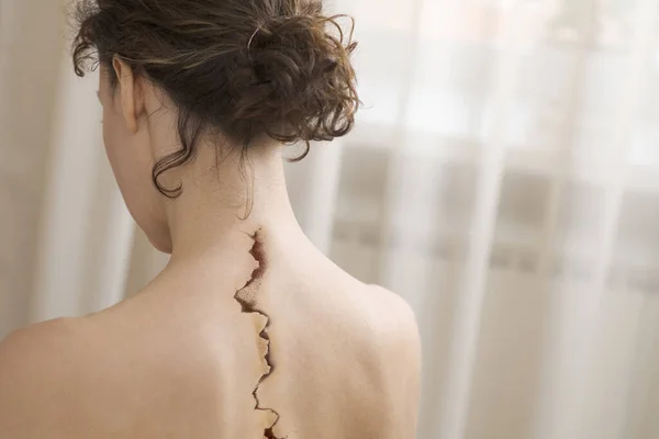 Vista Posterior Mujer Con Grieta Espalda —  Fotos de Stock