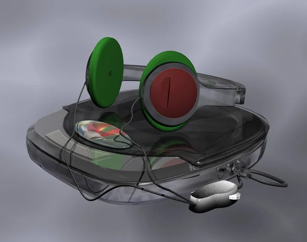 Музыкальный Плеер Walkman Магнитофон — стоковое фото