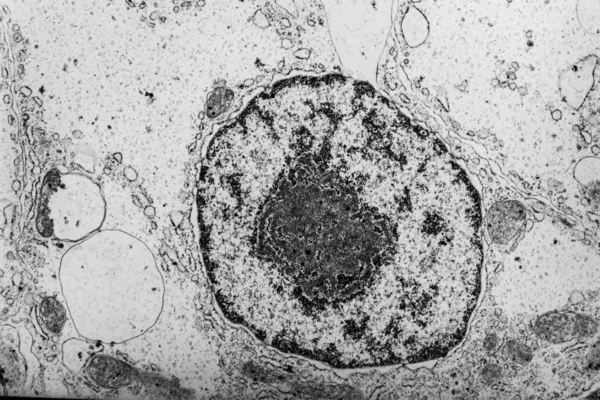 Microscopica Immagine Elettronica Del Tessuto Dei Pesci Rossi Decine Migliaia — Foto Stock