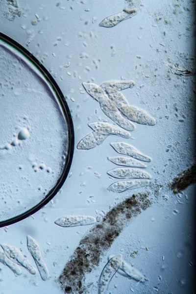 Trompet Parçacıkları Gölette Plankton — Stok fotoğraf