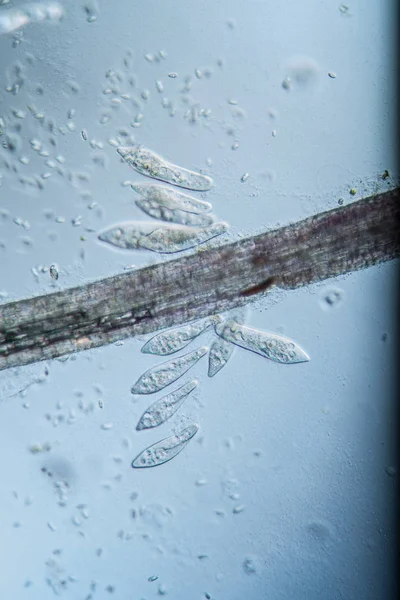 Trumpetpartiklar Plankton Dammen — Stockfoto