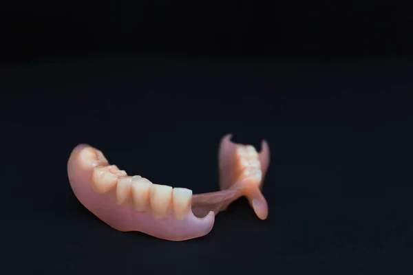 取り外し可能な入れ歯は柔軟性があり ナイロンがなく モノマーからの低刺激性の免除 — ストック写真
