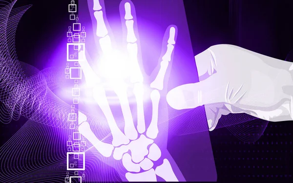 Hand Hält Einen Röntgenfilm — Stockfoto