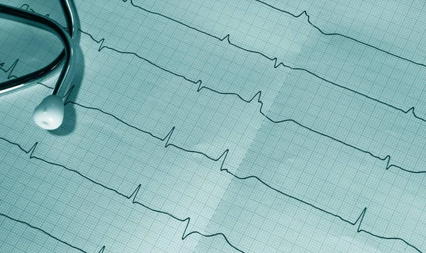 Cardiologia Batimento Cardíaco Ecg Serviço Ambulância — Fotografia de Stock