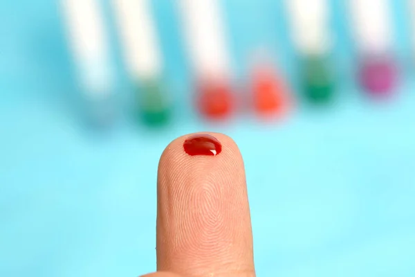 Diabético Está Fazendo Nível Glicose Teste Sangue Dedo — Fotografia de Stock