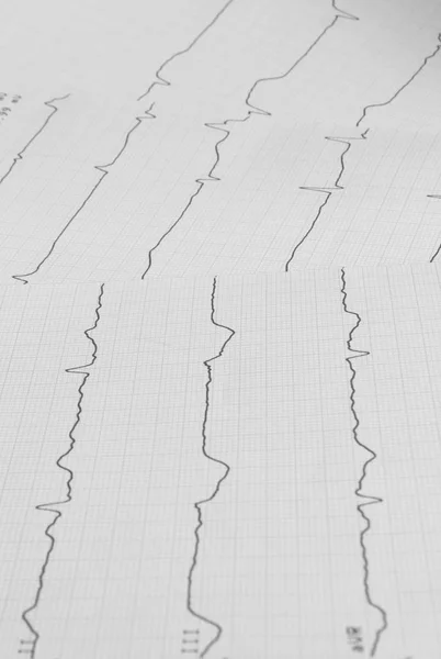 Cardiología Ecg Servicio Ambulancia —  Fotos de Stock