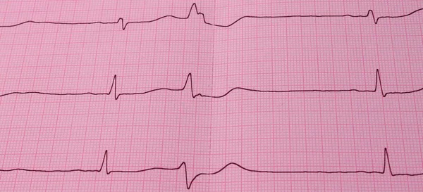Heartbeat Cardiology Ecg Ambulance Service — Stock Photo, Image