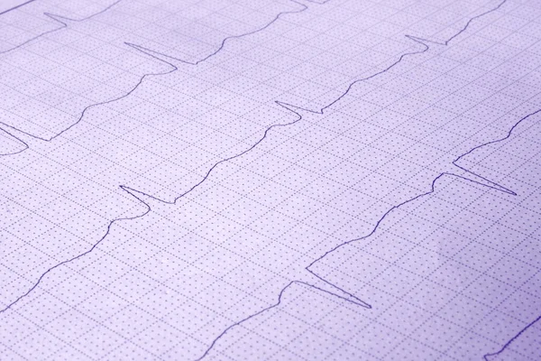 Heartbeat Cardiology Ecg Ambulans — Zdjęcie stockowe