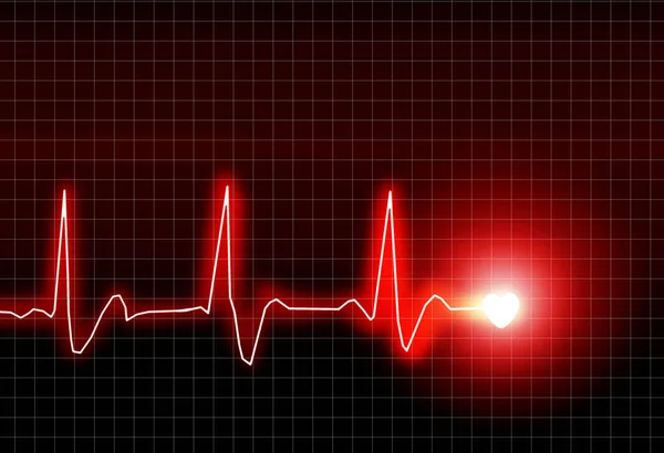 Cardiologia Del Battito Cardiaco Ecg Servizio Ambulanza — Foto Stock