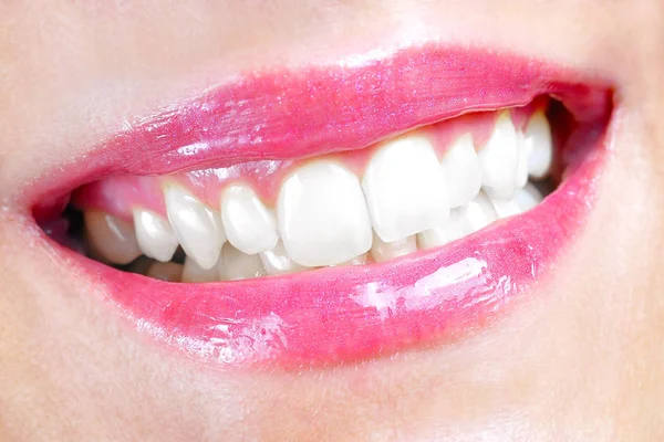 Sonriente Boca Mujer Con Grandes Dientes —  Fotos de Stock