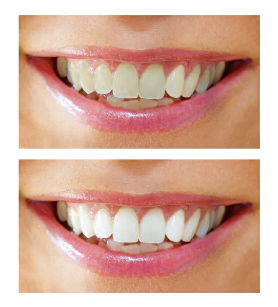 whitening effect - before and after