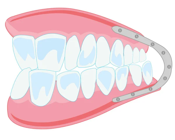 Векторна Ілюстрація Зубного Ряду Білому Тлі Ізольована — стокове фото