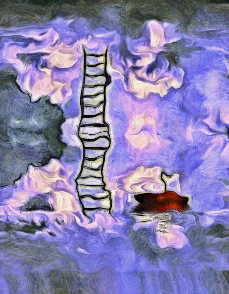 Composizione Metaforica Surreale Scaletta Ombrellone Rosso — Foto Stock