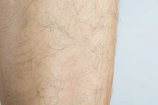 Cabelo Canela Homem Asiático Closeup Pele Com Cabelo Crescido — Fotografia de Stock