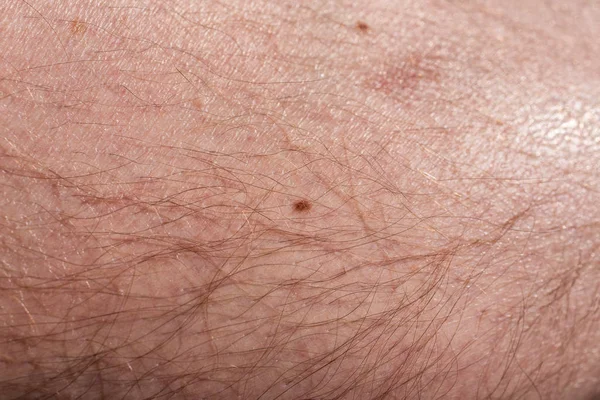 Very Hairy Men Skin — Stock Photo, Image