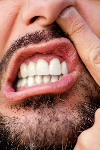 Κοντινό Πλάνο Του Προσώπου Ενός Άνδρα Γενειάδα Και Λευκά Δόντια — Φωτογραφία Αρχείου