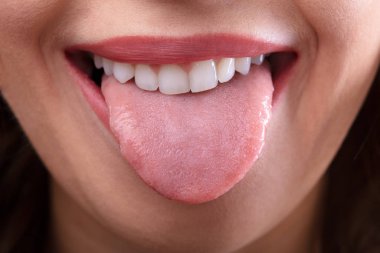 Close-up Of A Woman's Face Showing Her Clean Tongue clipart