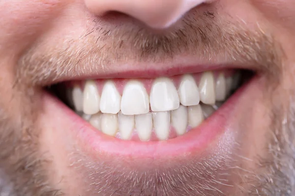 Primer Plano Hombre Feliz Con Dientes Sanos —  Fotos de Stock