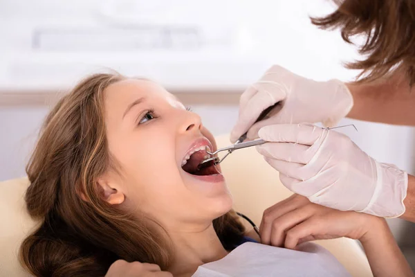クリニックでの歯科治療を行って女の子のクローズ アップ — ストック写真