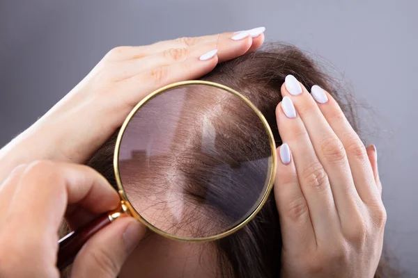 Ręka Dermatologa Badanie Kobiety Włosy Lupy — Zdjęcie stockowe