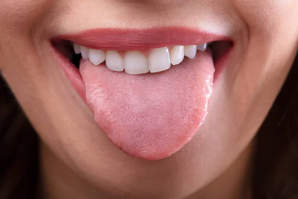 Close Rosto Uma Mulher Mostrando Sua Língua Limpa — Fotografia de Stock