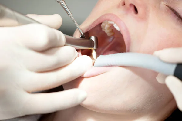 Visita Dentista Vista Perto — Fotografia de Stock
