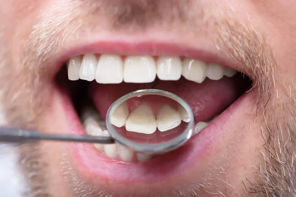 Γκρο Πλαν Ενός Ανθρώπου Που Έχοντας Οδοντιατρικό Έλεγχο Τον Οδοντίατρό — Φωτογραφία Αρχείου