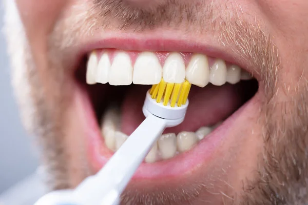 電動歯ブラシで歯を磨く人のクローズ アップ — ストック写真
