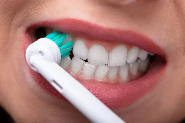 Primer Plano Mano Una Mujer Cepillando Los Dientes Con Cepillo —  Fotos de Stock