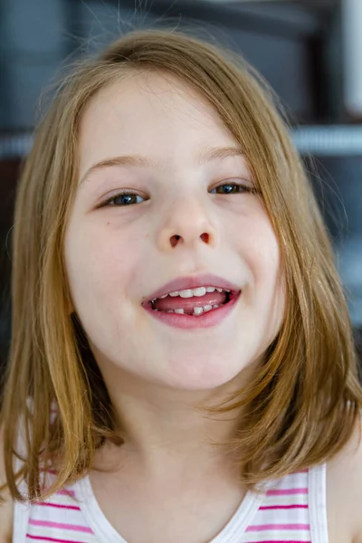 귀여운 그녀의 첫번째 손실된 이빨을 보여주는 — 스톡 사진