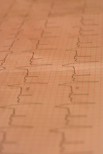 Cardiologia Batimento Cardíaco Ecg Serviço Ambulância — Fotografia de Stock