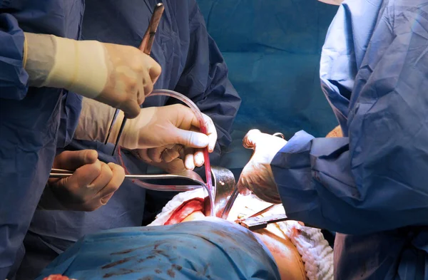 Hermann Josef医院Erkelenz的腹部手术 — 图库照片