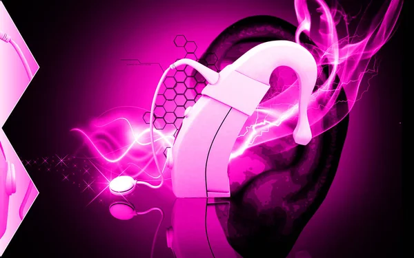 Digital Illustration Cochlear Implant Colour Background — Stockfoto