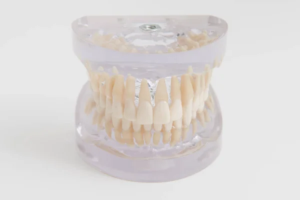 带透明假牙的上下颌假牙 — 图库照片