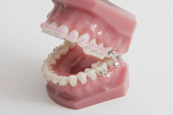 Una Dentiera Superiore Inferiore Mascelle Aperte Con Manichino Rosa — Foto Stock