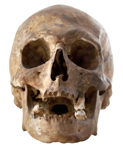 Close Photo Human Skull Elszigetelt Fehér Háttér Nyírás Útvonal — Stock Fotó