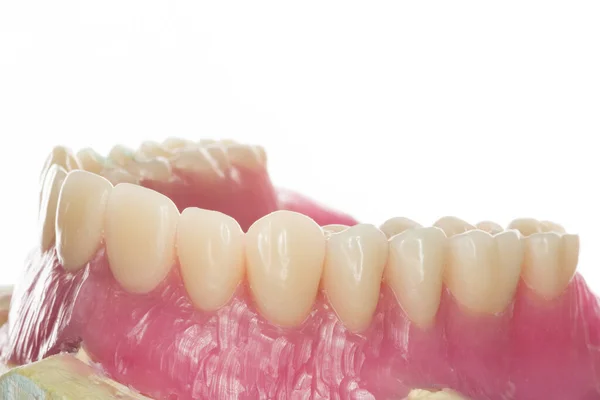 Modello Dentale Protesi Totale — Foto Stock