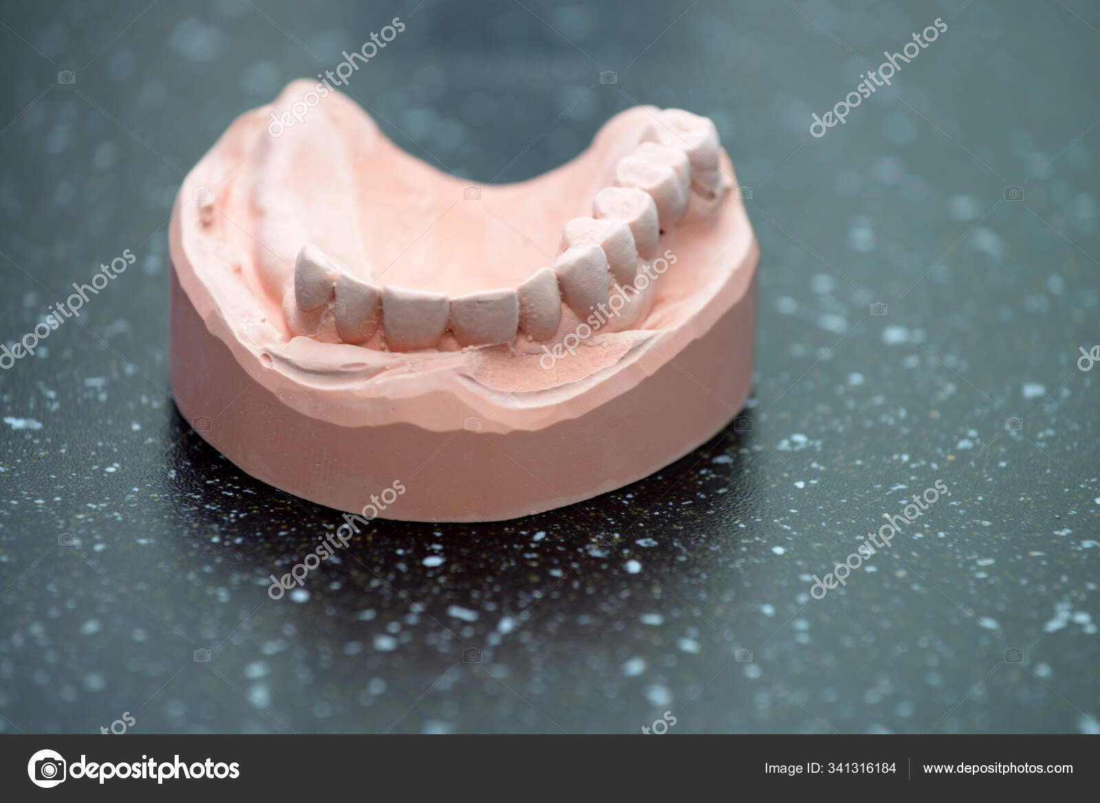 Dental Mold Tooth Decay Teeth Stock Photo by ©PantherMediaSeller 341316184