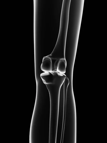 Διαφανές Γυναικείο Σκελετό Οστά Γόνατος — Φωτογραφία Αρχείου