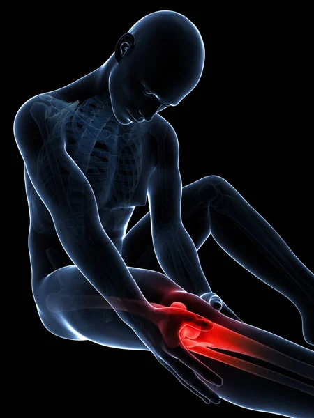 Rendered Illustration Pain Knee — Stock Photo, Image