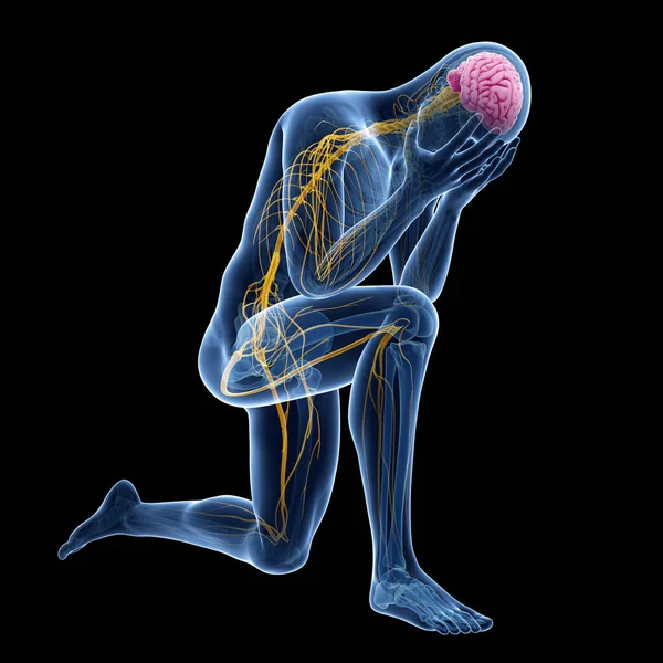 Depression Illustration Visible Anatomy — Stock Photo, Image