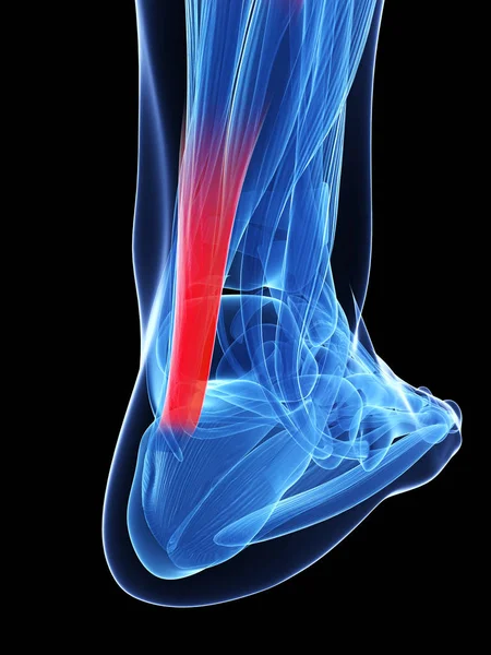 Rendered Illustration Achilles Tendon — Stock Photo, Image