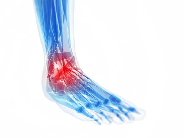 痛みを伴う足の3Dレンダリングイラスト — ストック写真